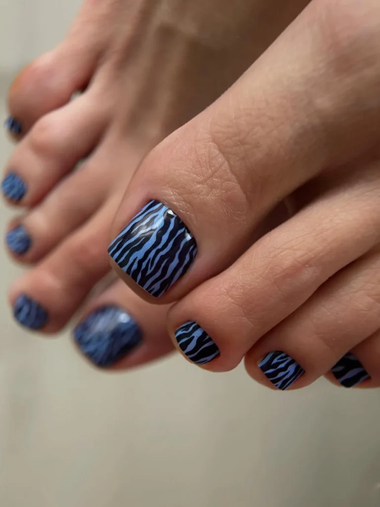 Pedicure Ideas - Summer Trends 2026 That Will Be Everywhere This Season
